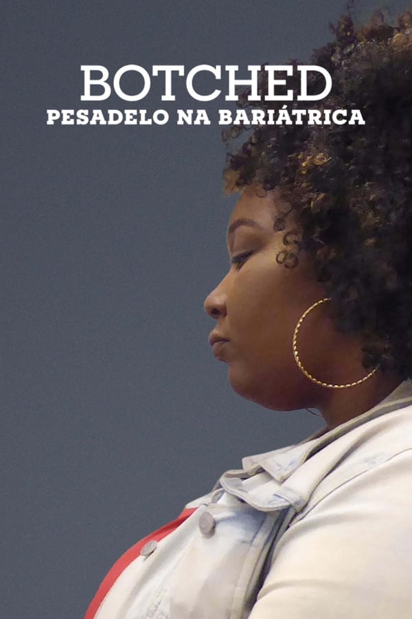 Botched Pesadelo na Bariatrica